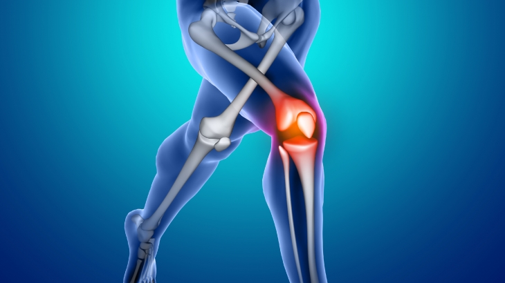 Osteoartrit Nedir (Kireçlenme)? Belirti ve Tedavisi Nasıl Olur?